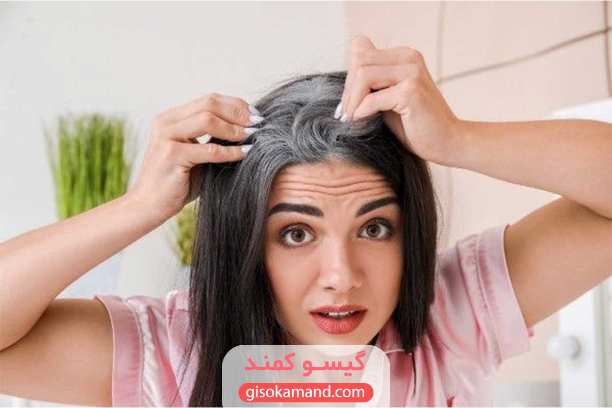 خاصیت بازتابی بالای موهای سفید