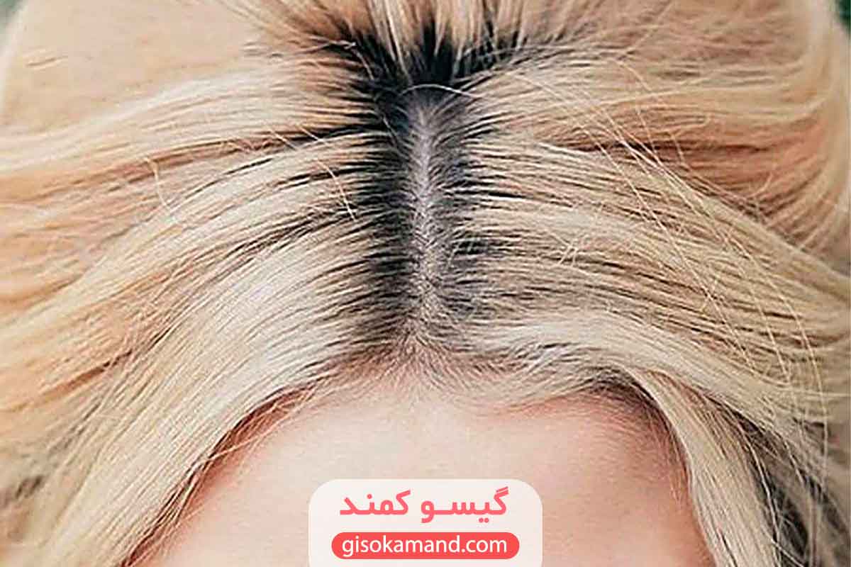 ترمیم ریشه بدون هماهنگی با ساقه 