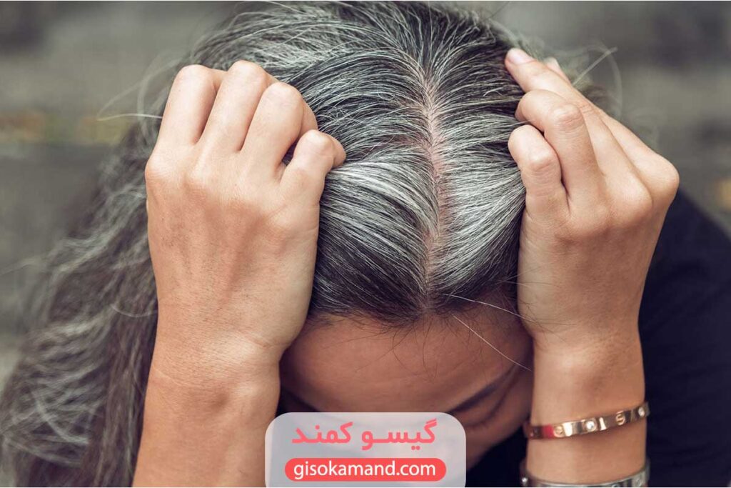 چرا موی سفید رنگ نمی گیره