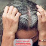 چرا موی سفید رنگ نمی گیره