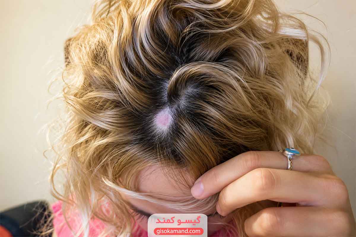آیا رنگ مو باعث ریزش مو می‌شود؟
