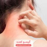 آیا رنگ مو برای بدن ضرر دارد؟