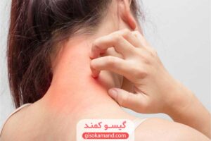 آیا رنگ مو برای بدن ضرر دارد؟