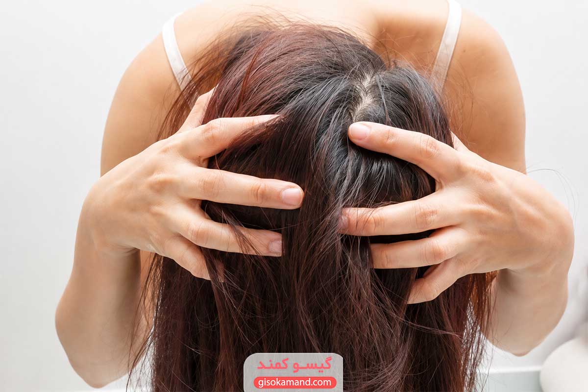 علائم حساسیت به PPD