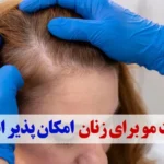 کاشب مو برای خانم ها