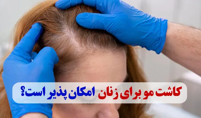 کاشب مو برای خانم ها